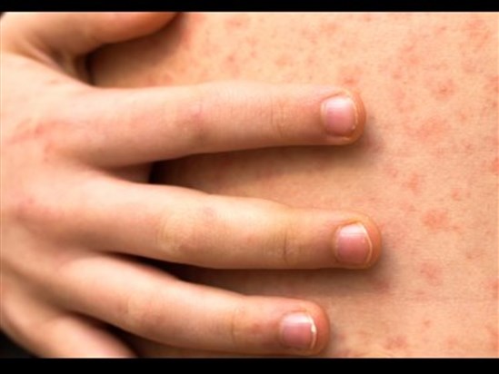 Les autorités appellent à la prudence durant la période des Fêtes